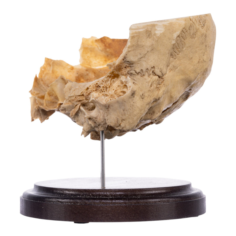 Real Human Partial Skull on Stand