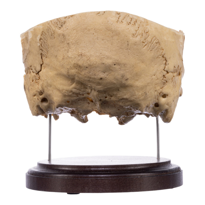 Real Human Partial Skull on Stand