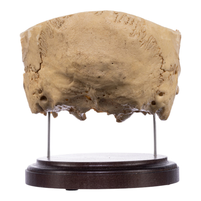 Real Human Partial Skull on Stand