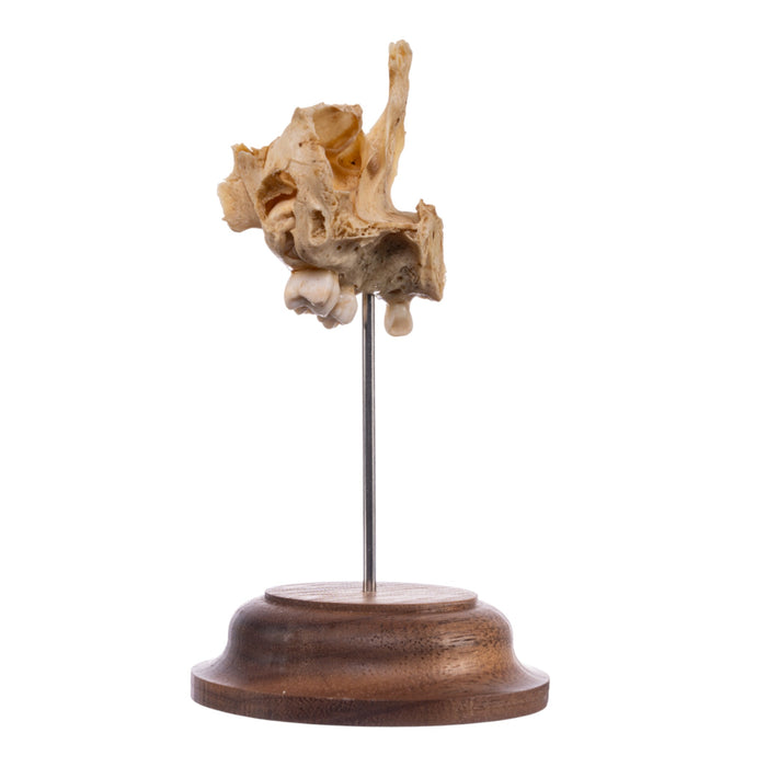 Real Human Partial Skull