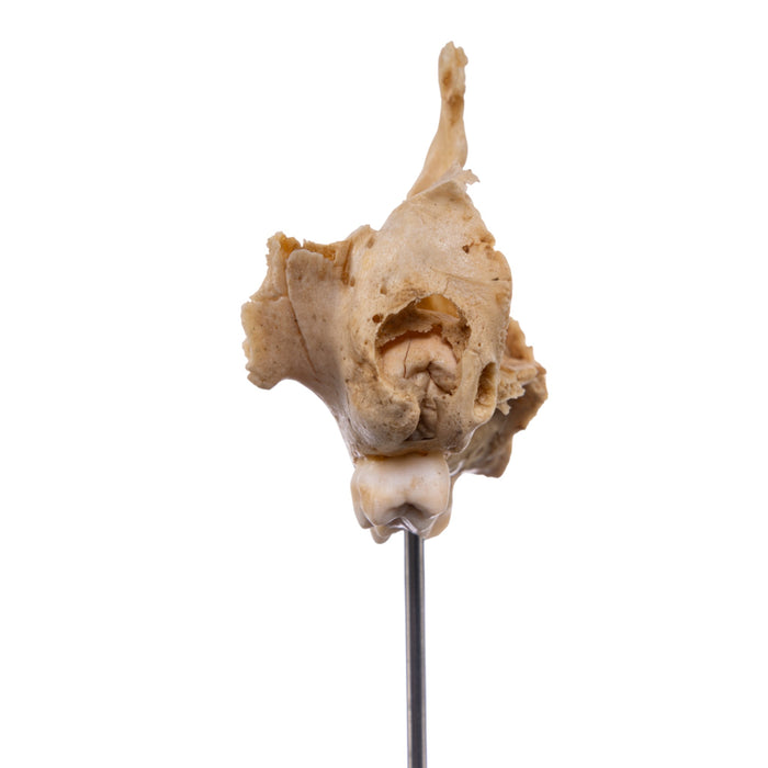 Real Human Partial Skull