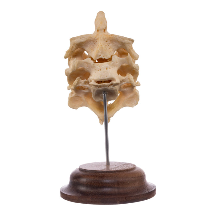 Real Human Atlas and Axis on Stand