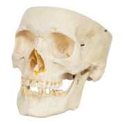 Real Human Skull - Partial