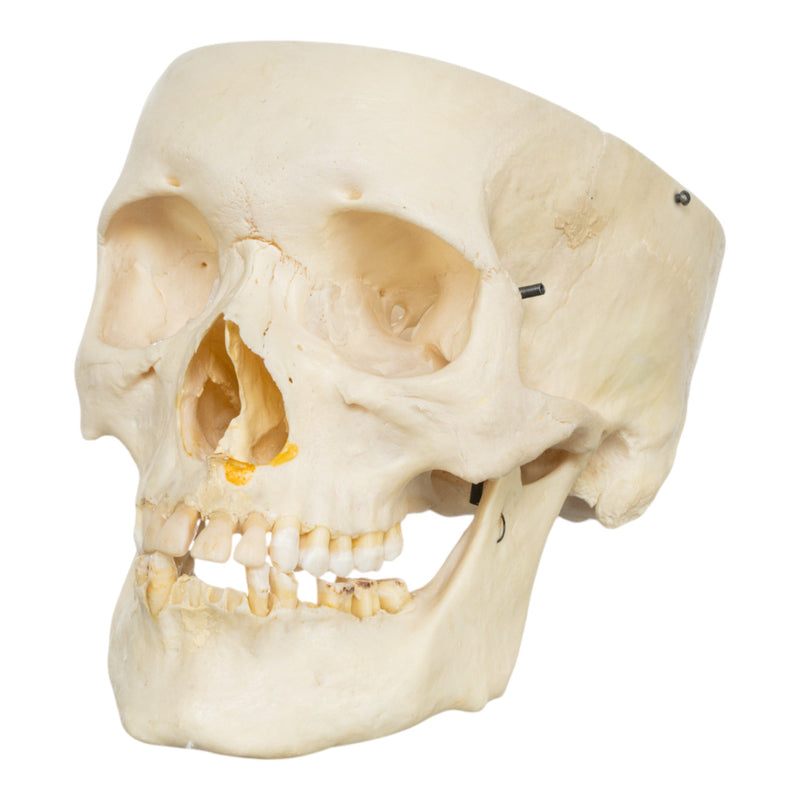 Real Human Skull - Partial