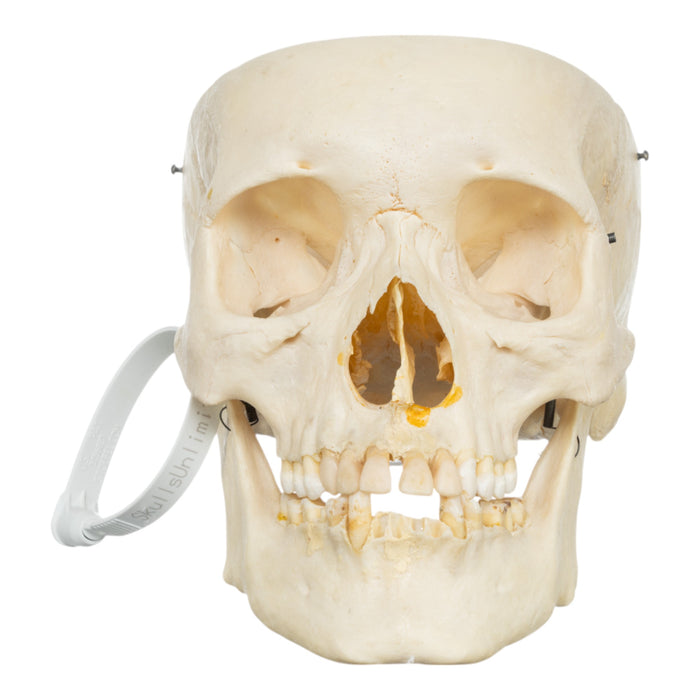 Real Human Skull - Partial