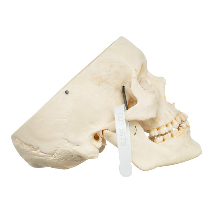 Real Human Skull - Partial