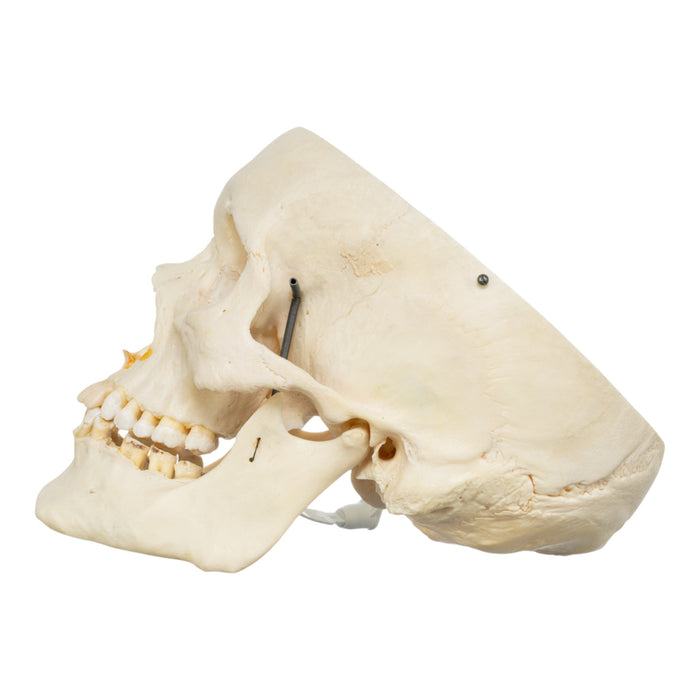 Real Human Skull - Partial