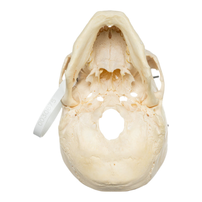 Real Human Skull - Partial