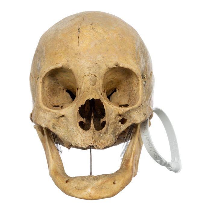 Real Human Skull