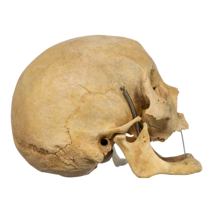 Real Human Skull