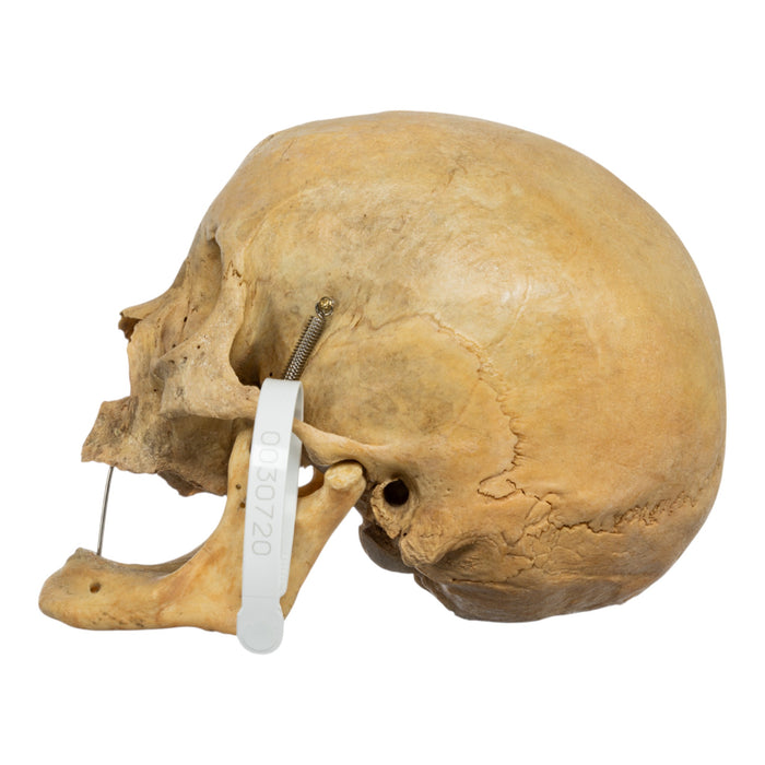 Real Human Skull