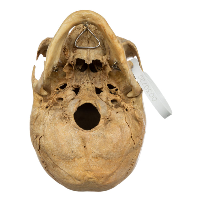 Real Human Skull