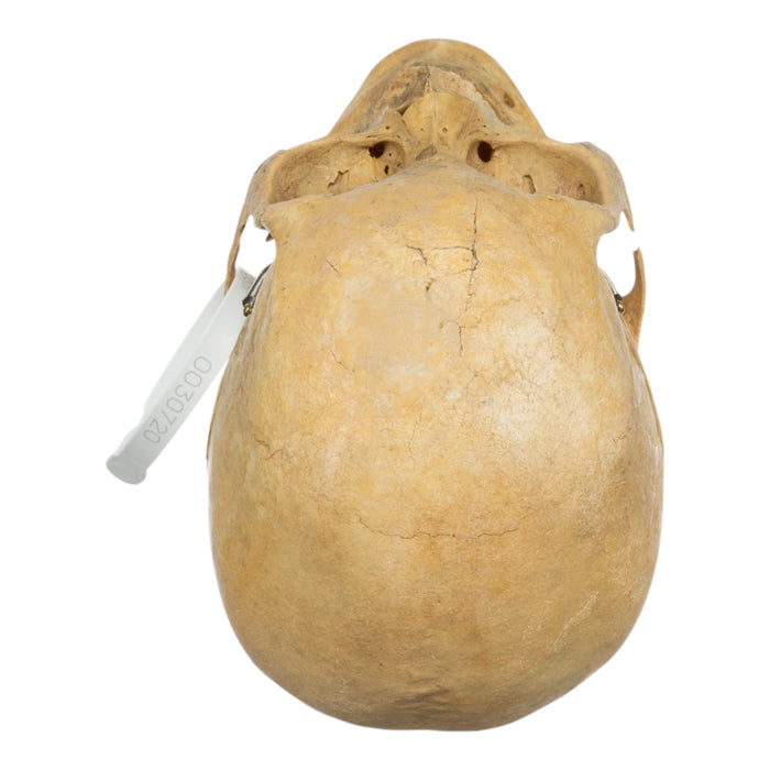 Real Human Skull