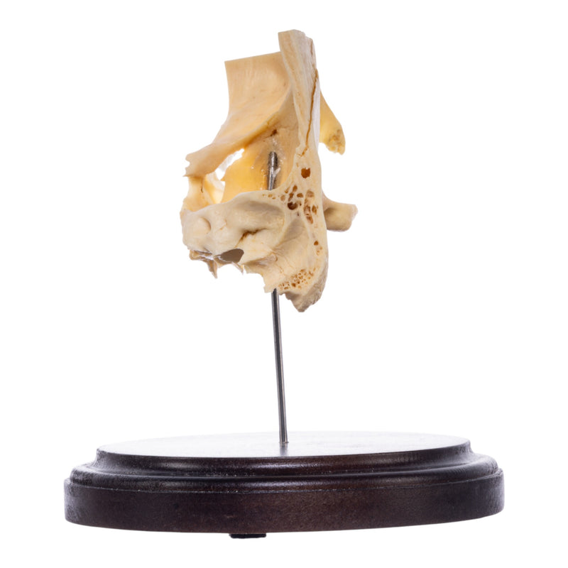 Real Human Partial Skull on Stand