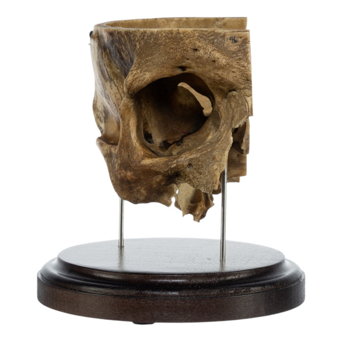 Real Human Partial Skull on Stand