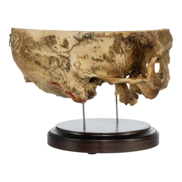 Real Human Partial Skull on Stand