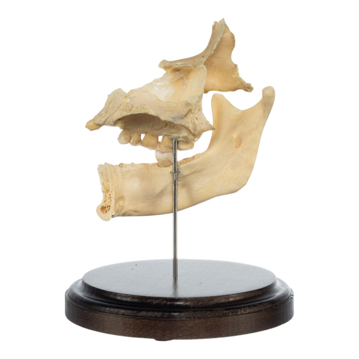 Real Human Partial Skull on Stand