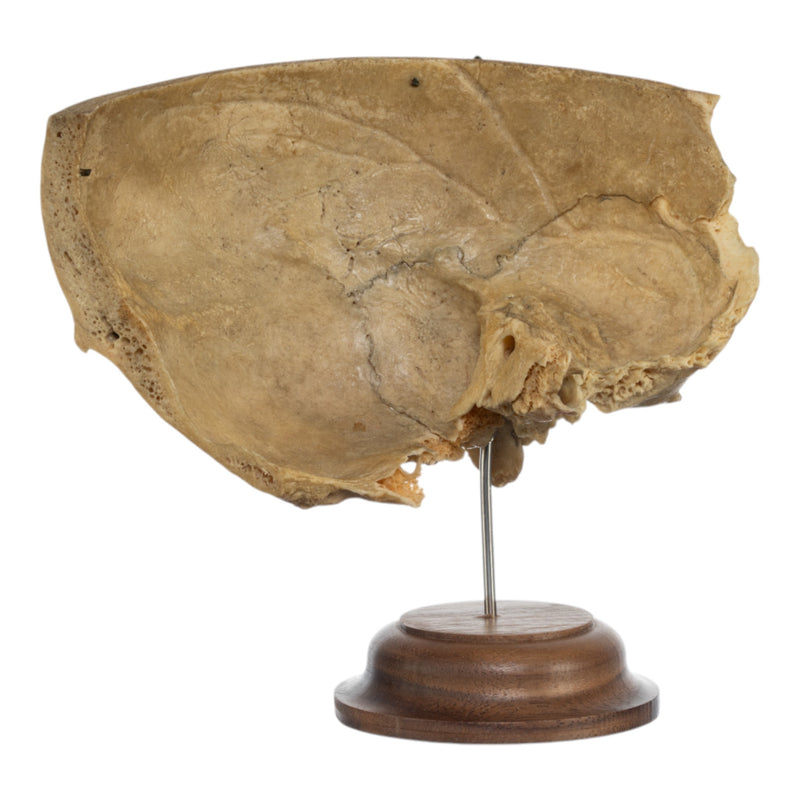 Real Human Partial Skull on Stand