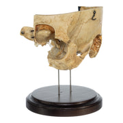 Real Human Partial Skull on Stand