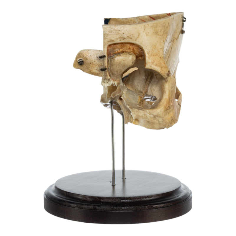 Real Human Partial Skull on Stand