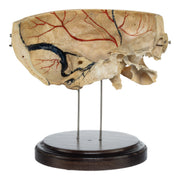 Real Human Partial Skull on Stand