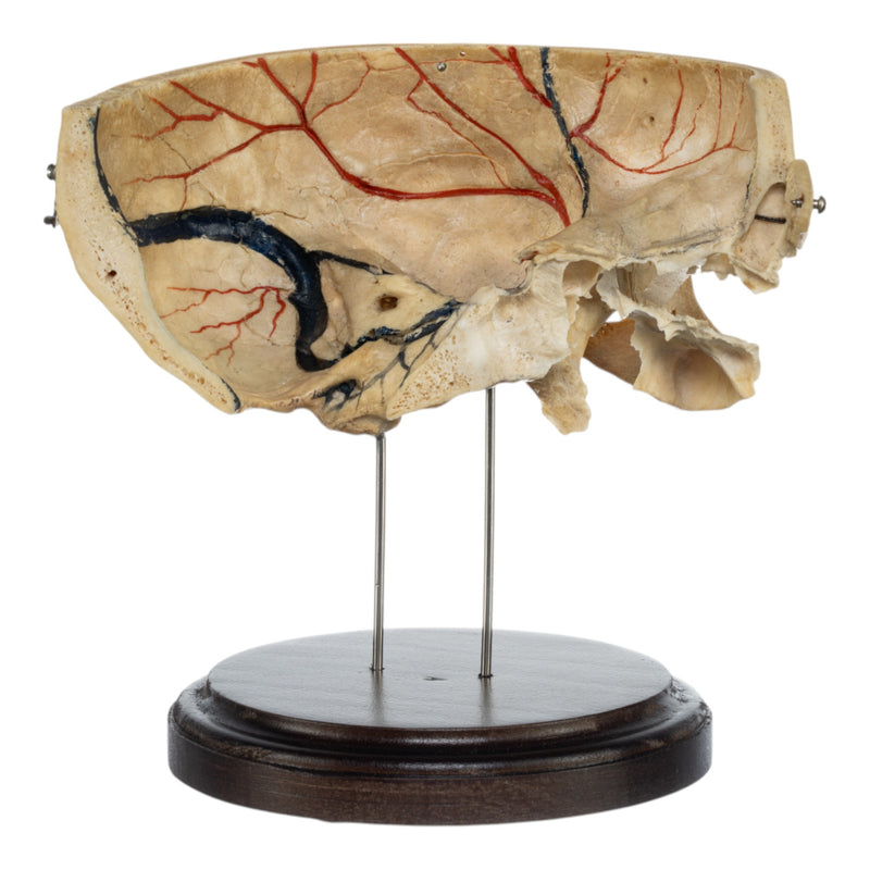 Real Human Partial Skull on Stand