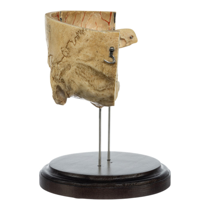 Real Human Partial Skull on Stand