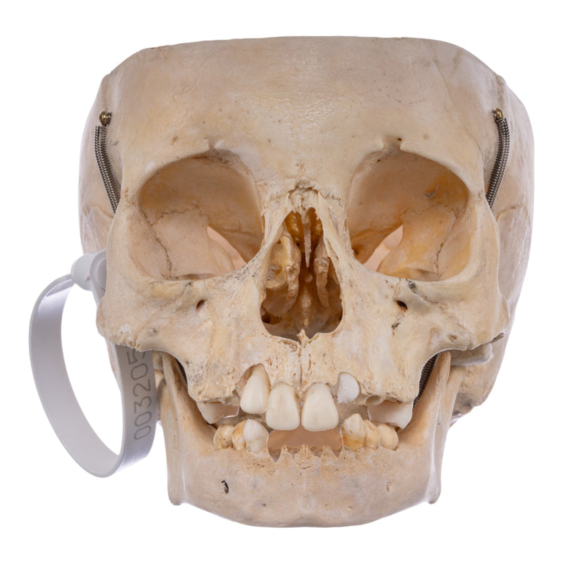 Real Human Partial Child Skull