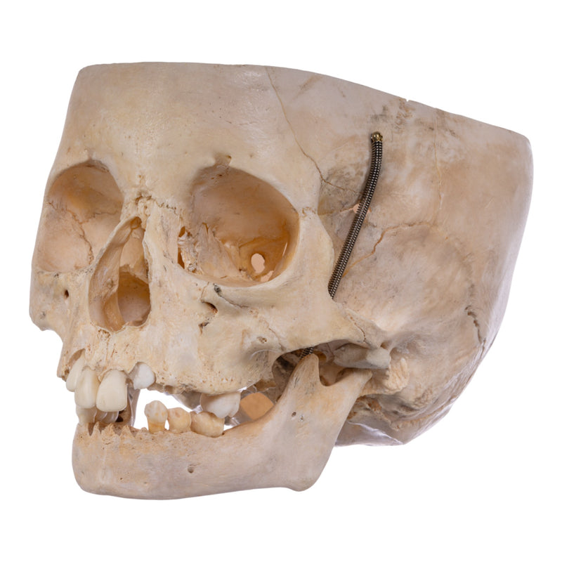 Real Human Partial Child Skull