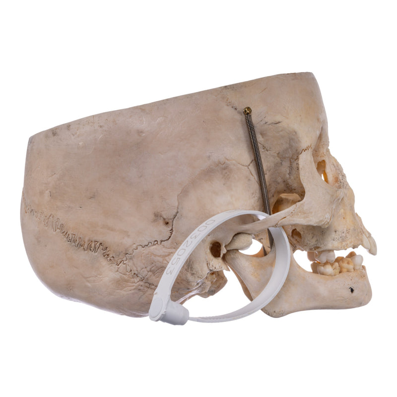 Real Human Partial Child Skull