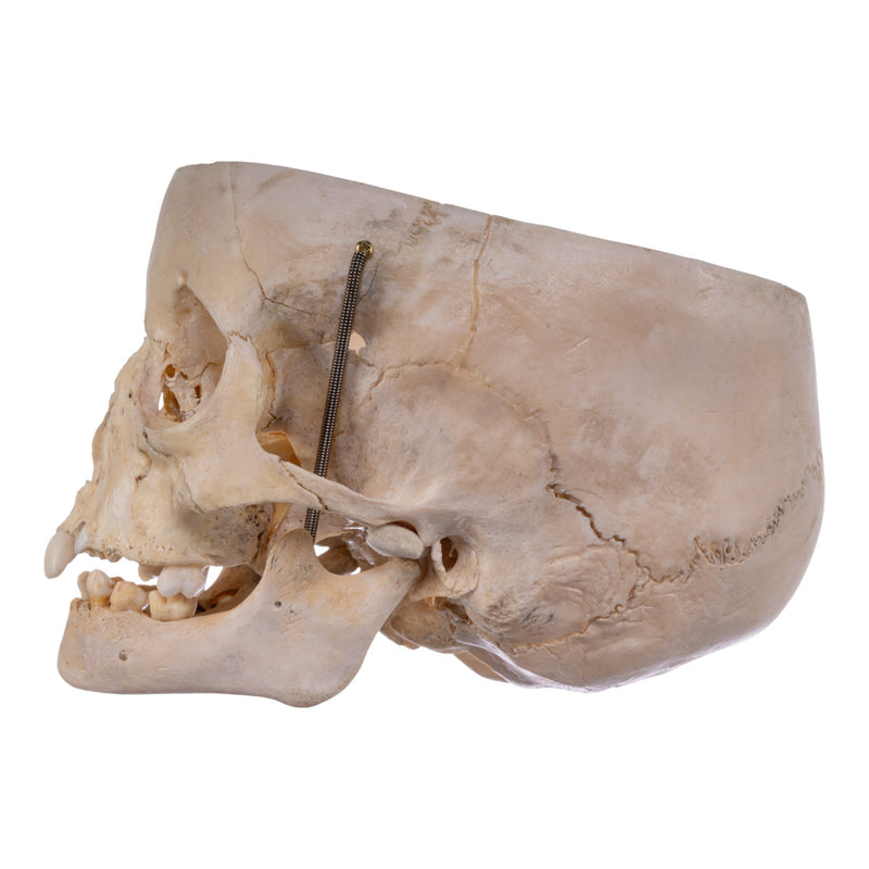 Real Human Partial Child Skull