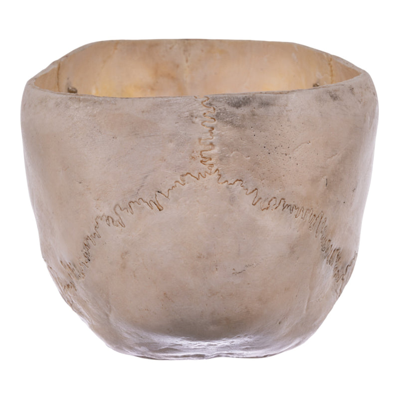 Real Human Partial Child Skull