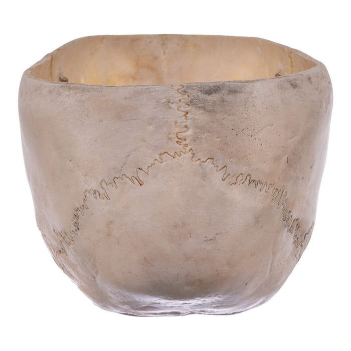 Real Human Partial Child Skull