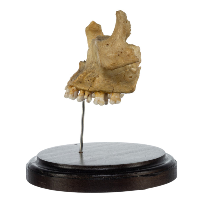 Real Human Partial Skull on Stand
