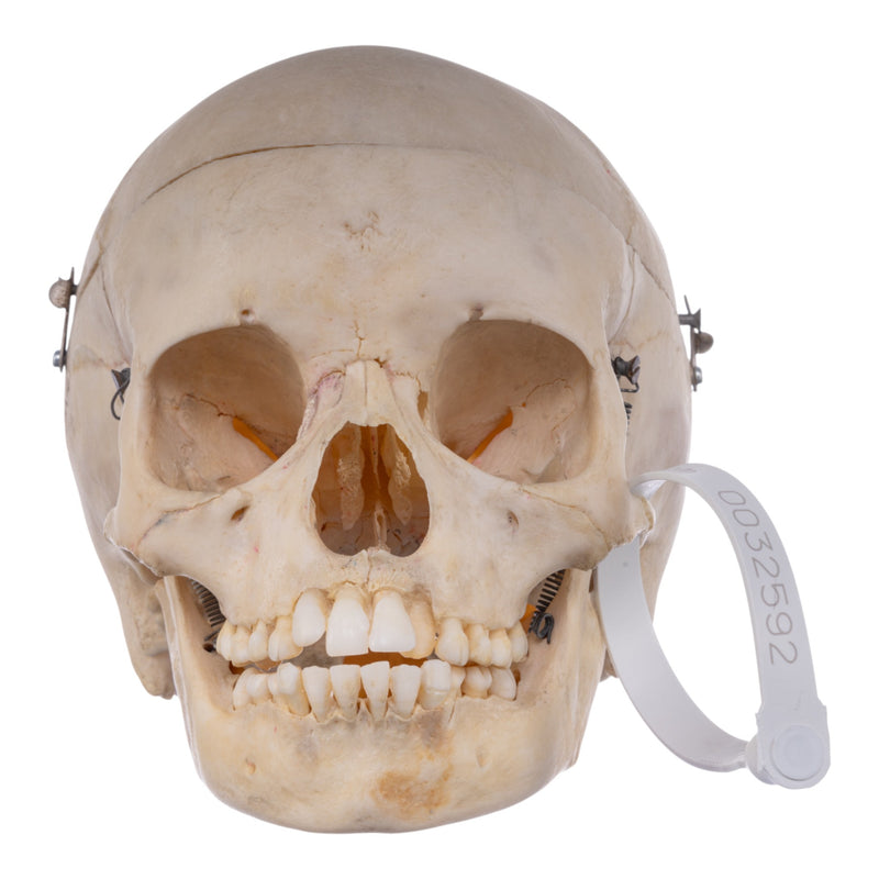 Real Human Child Skull