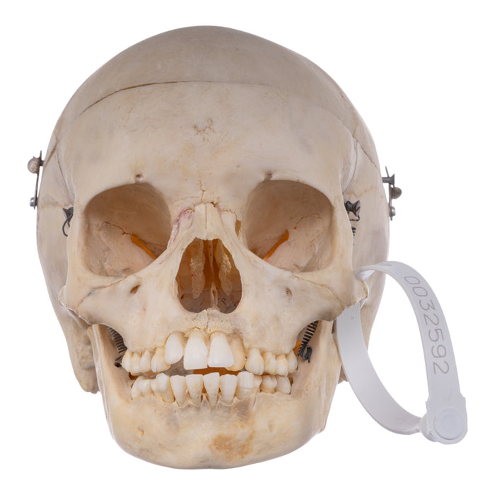 Real Human Child Skull