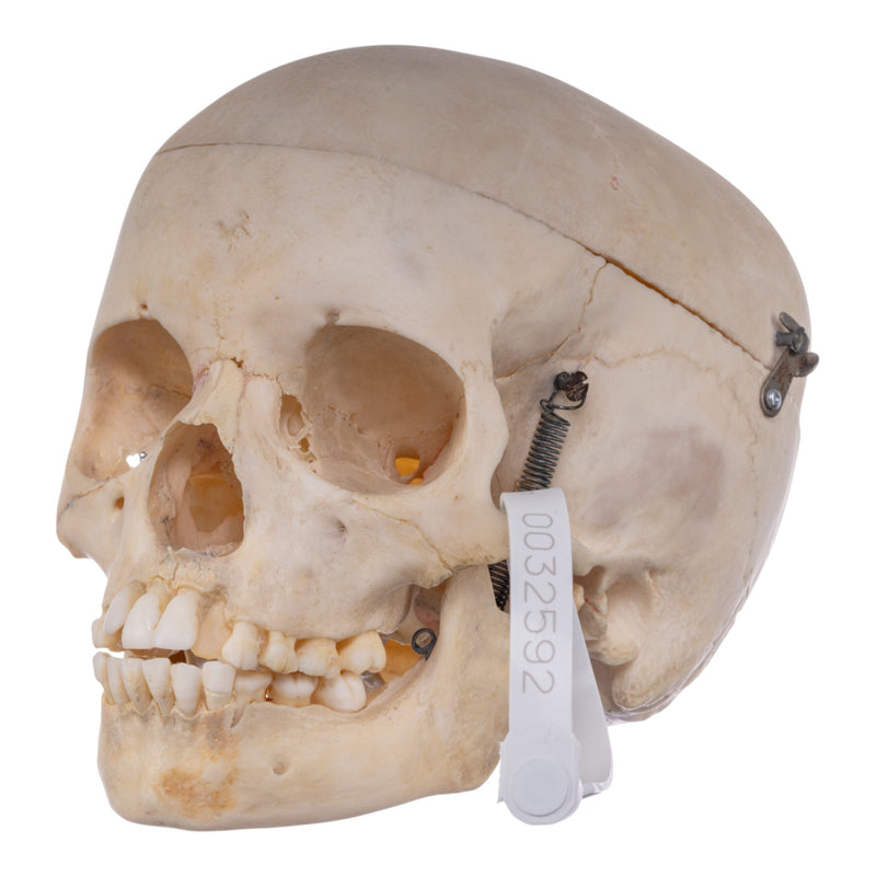 Real Human Child Skull