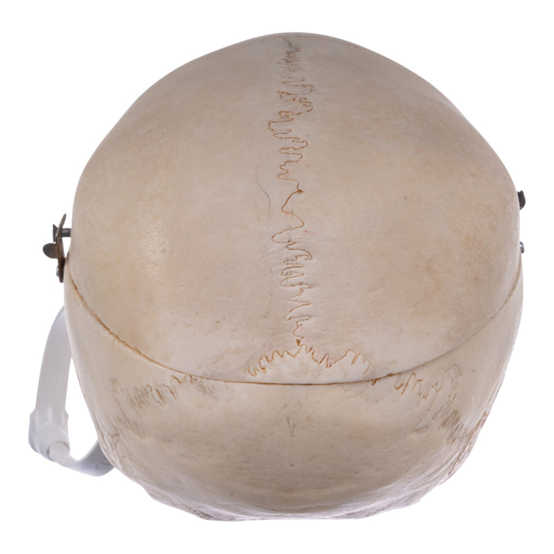 Real Human Child Skull