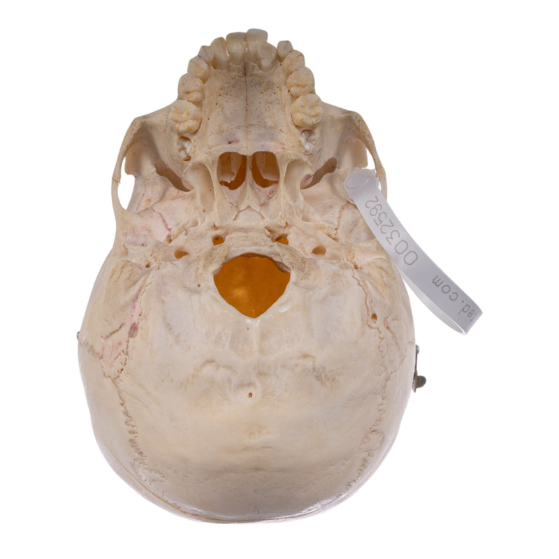 Real Human Child Skull
