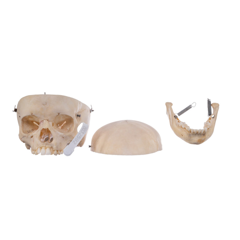 Real Human Child Skull