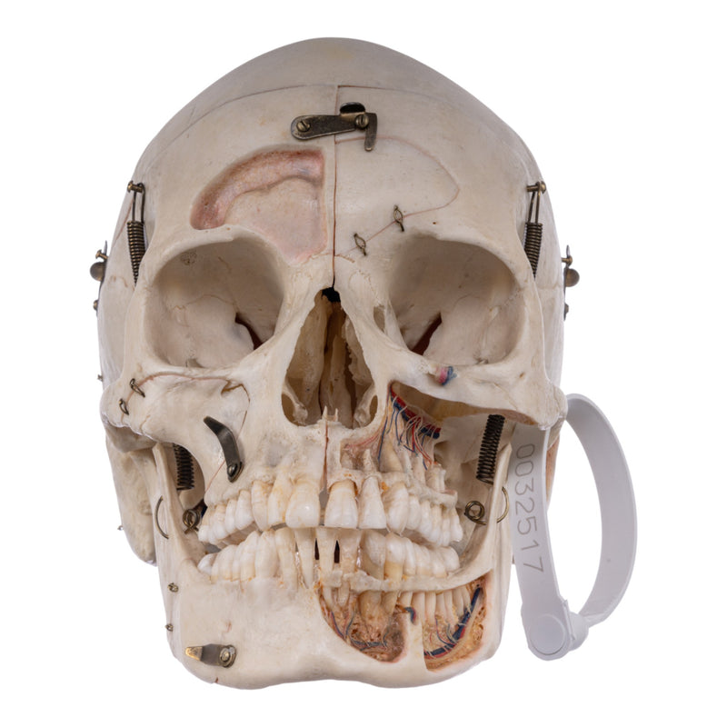 Real Human Skull - Dissected
