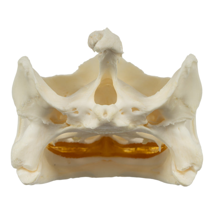Real Snapping Turtle Skull - Large (Pathology)