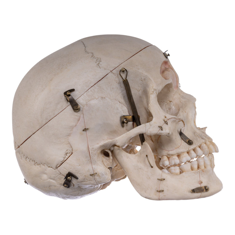 Real Human Skull - Dissected