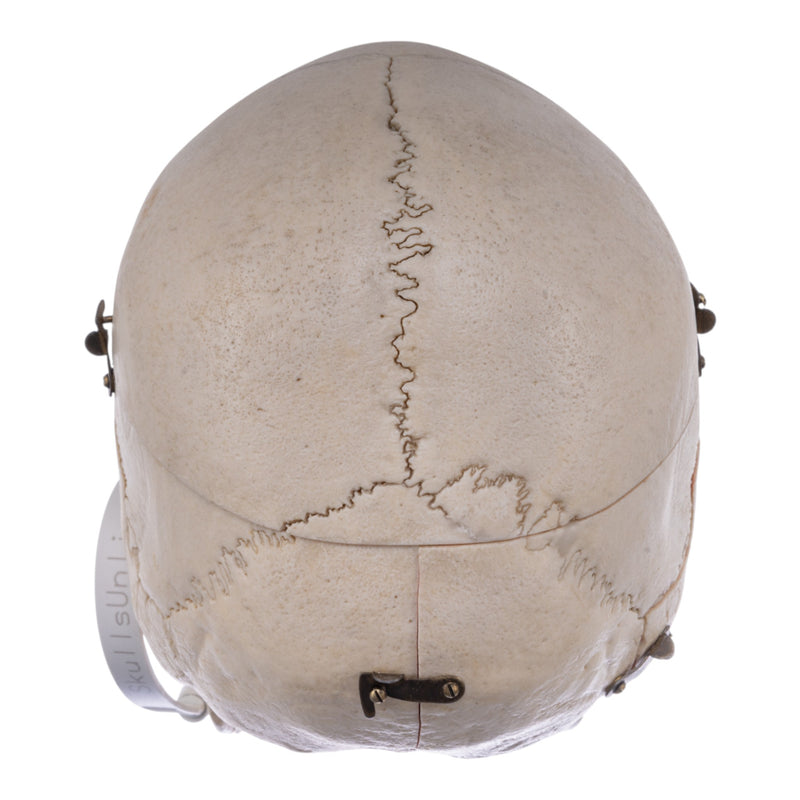 Real Human Skull - Dissected