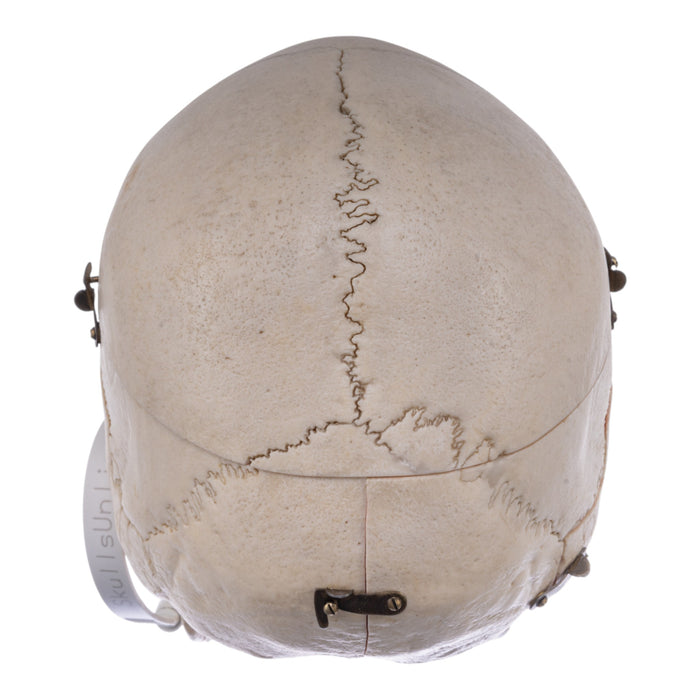 Real Human Skull - Dissected