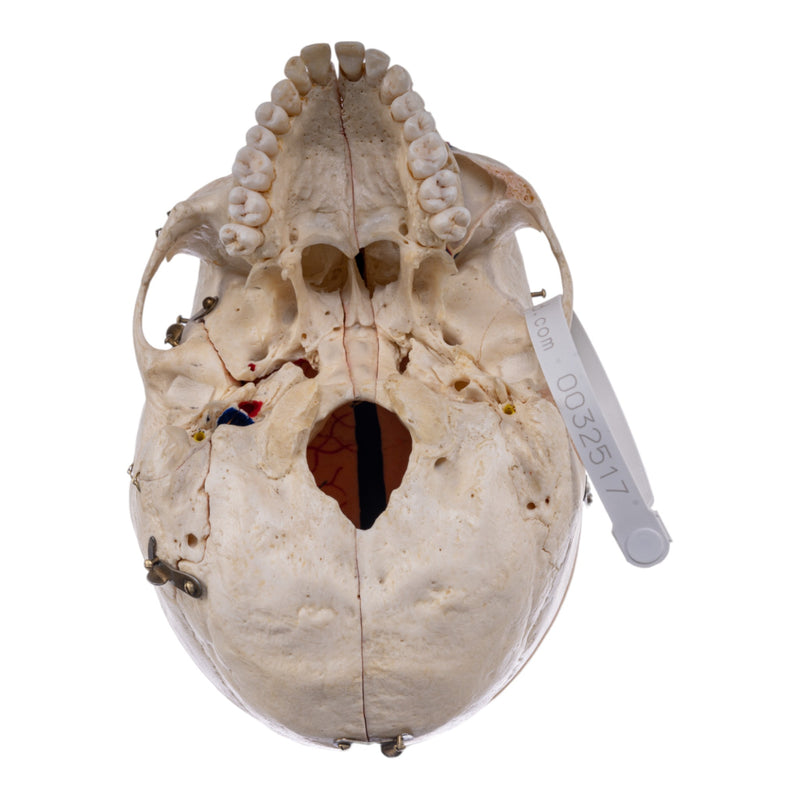Real Human Skull - Dissected