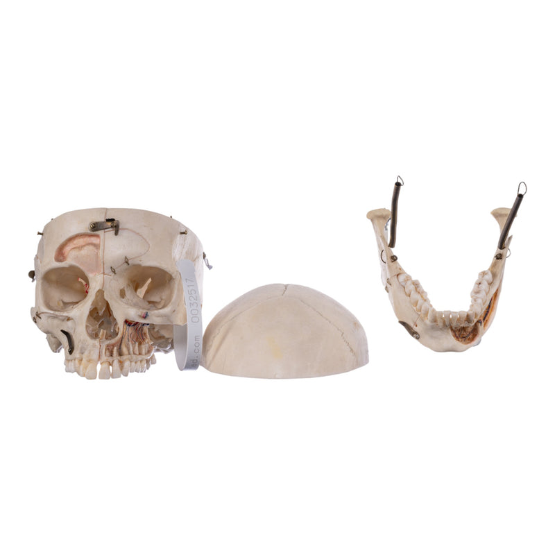 Real Human Skull - Dissected