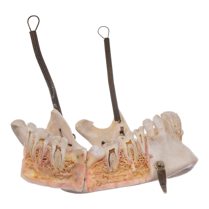 Real Human Skull - Dissected