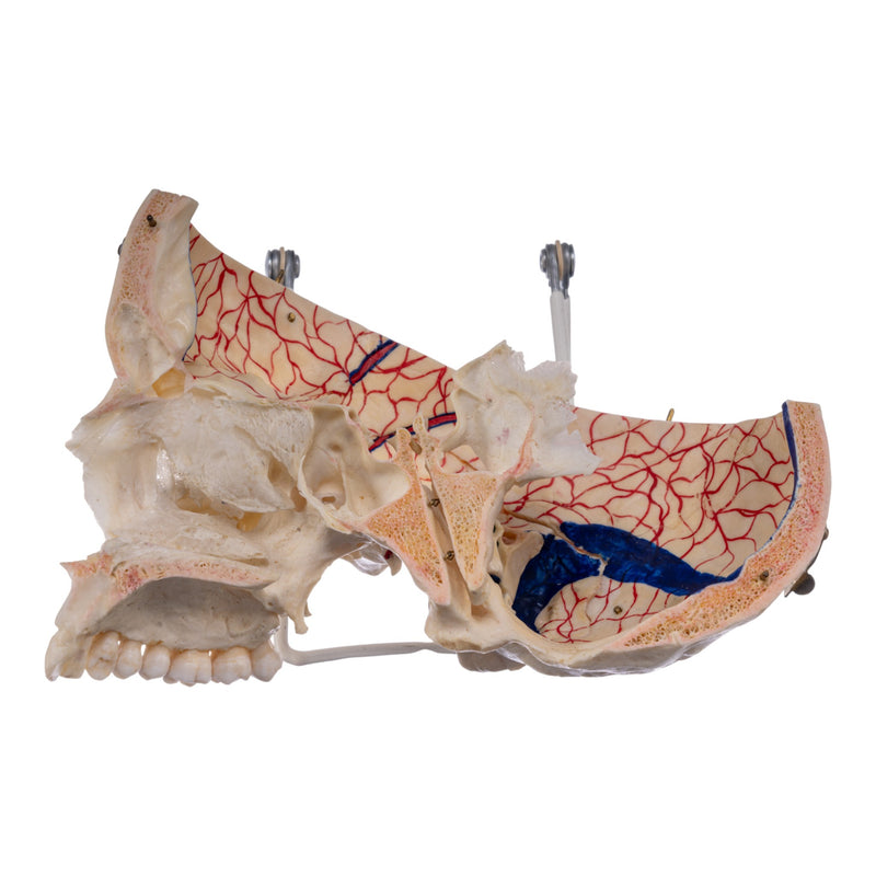 Real Human Skull - Dissected