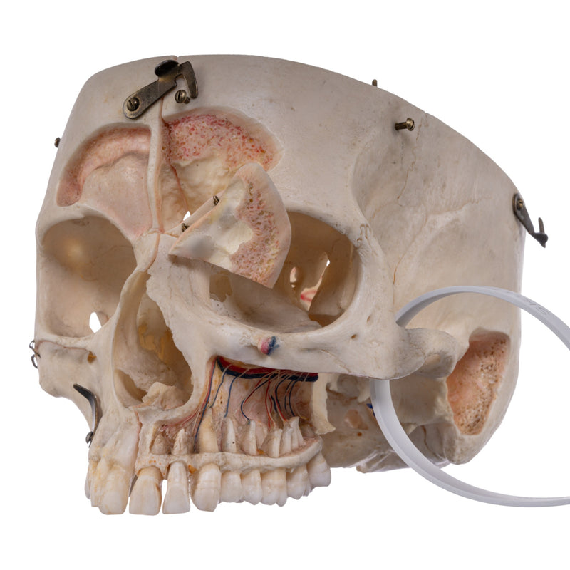 Real Human Skull - Dissected